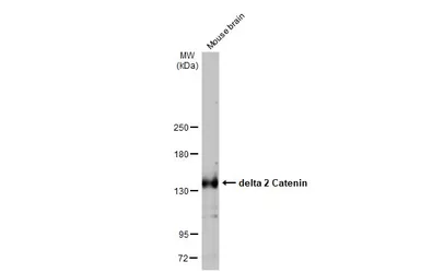 Anti-delta 2 Catenin antibody  [HL1629] used in Western Blot (WB). GTX637122