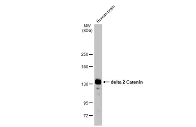 Anti-delta 2 Catenin antibody  [HL1629] used in Western Blot (WB). GTX637122