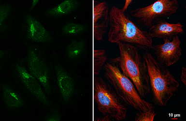 Anti-ROCK1 + ROCK2 antibody [HL1632] used in Immunocytochemistry/ Immunofluorescence (ICC/IF). GTX637125