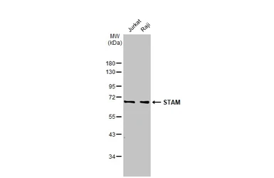 Anti-STAM antibody [HL1635] used in Western Blot (WB). GTX637128