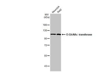 Anti-O-GlcNAc transferase antibody [HL1642] used in Western Blot (WB). GTX637223