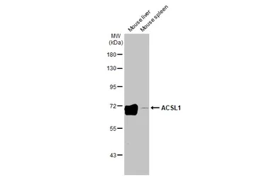 Anti-ACSL1 antibody [HL1651] used in Western Blot (WB). GTX637232