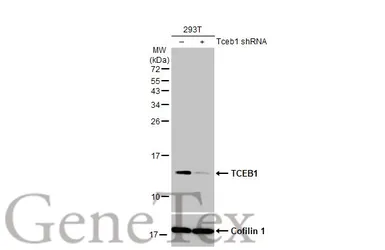 Anti-TCEB1 antibody [HL1683] used in Western Blot (WB). GTX637282