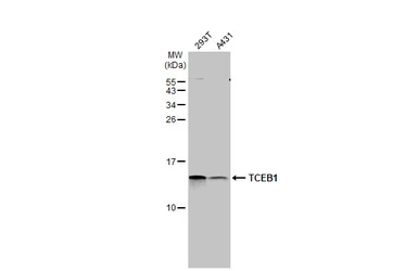 Anti-TCEB1 antibody [HL1683] used in Western Blot (WB). GTX637282