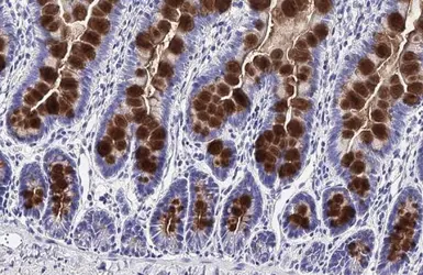 Anti-MUC2 antibody [HL1724] used in IHC (Paraffin sections) (IHC-P). GTX637372