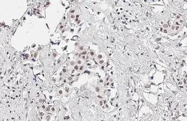 Anti-KDM6A antibody [HL1731] used in IHC (Paraffin sections) (IHC-P). GTX637379