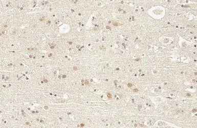 Anti-KDM6A antibody [HL1731] used in IHC (Paraffin sections) (IHC-P). GTX637379