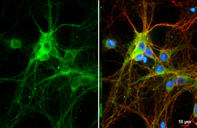 Anti-Bassoon antibody [HL1732] used in Immunocytochemistry/ Immunofluorescence (ICC/IF). GTX637380