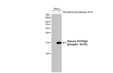 Anti-Histone H3S10ph (phospho Ser10) antibody [HL1752] used in Western Blot (WB). GTX637402