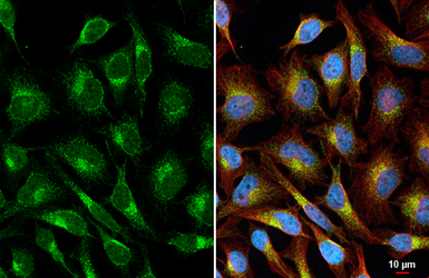 Anti-VEGFA antibody [HL1755] used in Immunocytochemistry/ Immunofluorescence (ICC/IF). GTX637405
