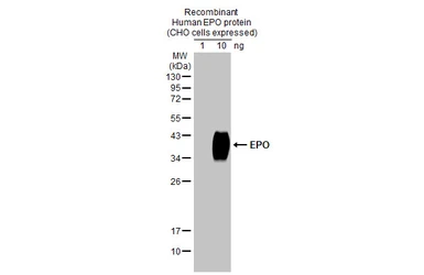 Anti-EPO antibody [HL1793] used in Western Blot (WB). GTX637445