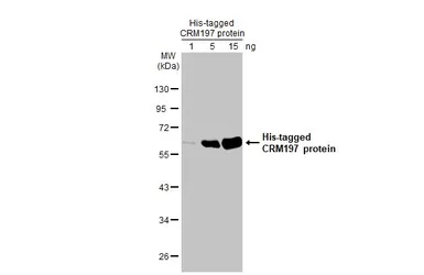 Anti-CRM197 antibody [HL1808] used in Western Blot (WB). GTX637460