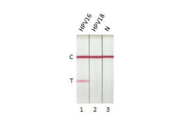 Anti-Human Papillomavirus type 16 E7 antibody [HL1821] used in Lateral Flow (Lateral Flow). GTX637546