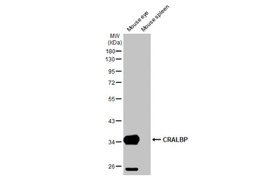 Anti-CRALBP antibody [HL1833] used in Western Blot (WB). GTX637558