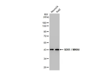 Anti-SEK1 / MKK4 antibody [HL1839] used in Western Blot (WB). GTX637564