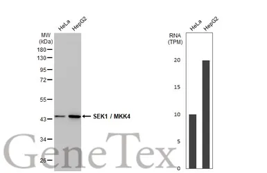 Anti-SEK1 / MKK4 antibody [HL1839] used in Western Blot (WB). GTX637564
