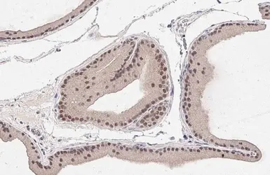 Anti-SEK1 / MKK4 antibody [HL1839] used in IHC (Paraffin sections) (IHC-P). GTX637564