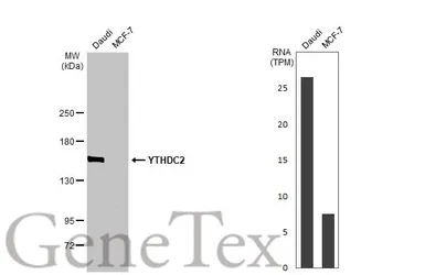 Anti-YTHDC2 antibody [HL1861] used in Western Blot (WB). GTX637586
