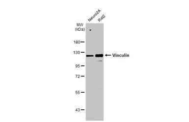 Anti-Vinculin antibody [HL1873] used in Western Blot (WB). GTX637622