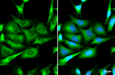 Anti-ZC3HAV1 antibody [HL1884] used in Immunocytochemistry/ Immunofluorescence (ICC/IF). GTX637633