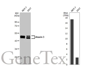 Anti-Ataxin 3 antibody [HL1909] used in Western Blot (WB). GTX637658