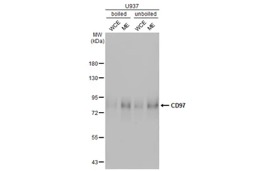 Anti-CD97 antibody [HL1925] used in Western Blot (WB). GTX637674