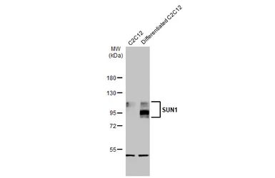 Anti-SUN1 antibody [HL1947] used in Western Blot (WB). GTX637784