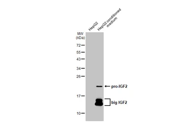 Anti-IGF2 antibody [HL1982] used in Western Blot (WB). GTX637875
