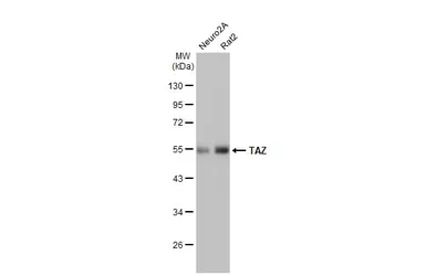 Anti-TAZ antibody [HL2032] used in Western Blot (WB). GTX637933