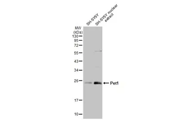 Anti-Pet1 antibody [HL2043] used in Western Blot (WB). GTX637944