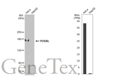 Anti-PODXL antibody [HL2047] used in Western Blot (WB). GTX637951