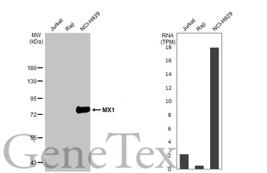 Anti-MX1 antibody [HL2051] used in Western Blot (WB). GTX637955