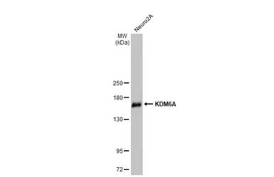 Anti-KDM6A antibody [HL2068] used in Western Blot (WB). GTX637972