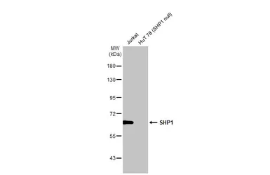 Anti-SHP1 antibody [HL20845] used in Western Blot (WB). GTX637993