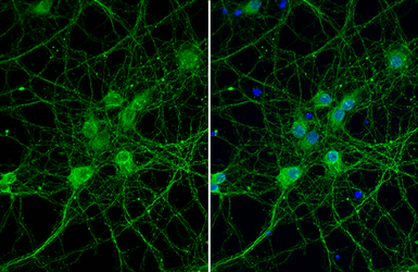 Anti-PIN1 antibody [HL2115] used in Immunocytochemistry/ Immunofluorescence (ICC/IF). GTX638087