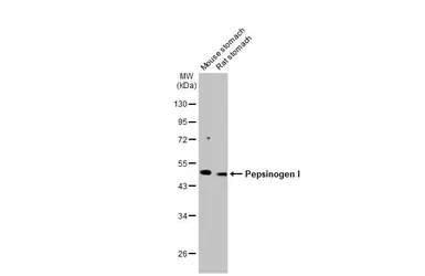 Anti-Pepsinogen I antibody [HL2137] used in Western Blot (WB). GTX638109