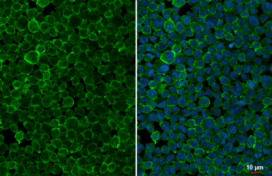 Anti-Pepsinogen I antibody [HL2137] used in Immunocytochemistry/ Immunofluorescence (ICC/IF). GTX638109