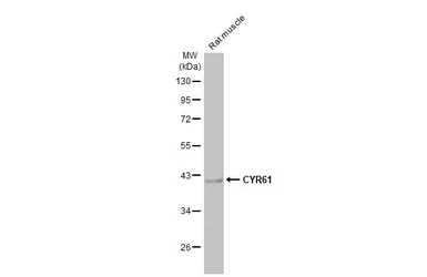 Anti-CYR61 antibody [HL2144] used in Western Blot (WB). GTX638122