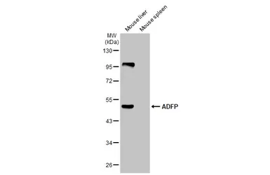 Anti-ADFP antibody [HL2145] used in Western Blot (WB). GTX638123