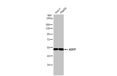 Anti-ADFP antibody [HL2147] used in Western Blot (WB). GTX638125