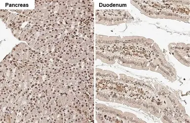 Anti-Rad21 antibody [HL2171] used in IHC (Paraffin sections) (IHC-P). GTX638175