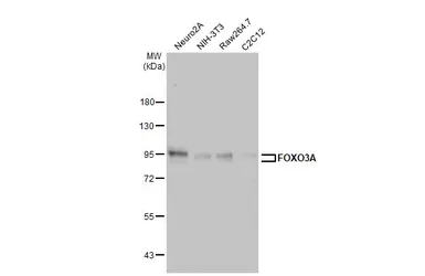 Anti-FOXO3A antibody [HL2190] used in Western Blot (WB). GTX638194