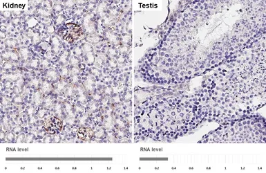 Anti-NPR-C antibody [HL2200] used in IHC (Paraffin sections) (IHC-P). GTX638204