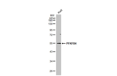 Anti-PFKFB4 antibody [HL2204] used in Western Blot (WB). GTX638208