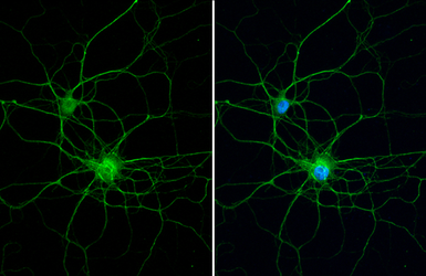 Anti-PKC gamma antibody [HL2227] used in Immunocytochemistry/ Immunofluorescence (ICC/IF). GTX638272