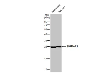 Anti-SIGMAR1 antibody [HL2230] used in Western Blot (WB). GTX638275