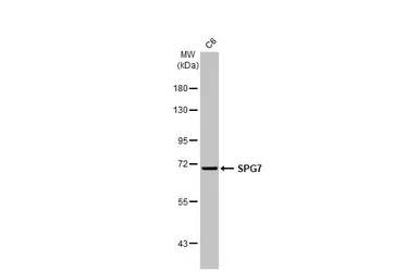 Anti-SPG7 antibody [HL2236] used in Western Blot (WB). GTX638281
