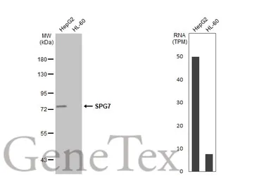 Anti-SPG7 antibody [HL2236] used in Western Blot (WB). GTX638281