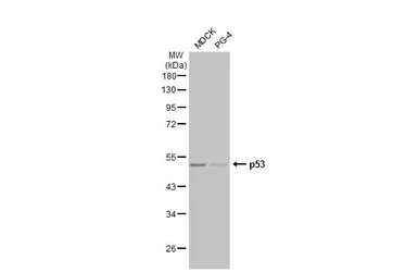 Anti-p53 antibody [HL2242] used in Western Blot (WB). GTX638291