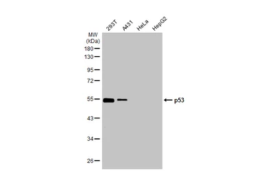 Anti-p53 antibody [HL2242] used in Western Blot (WB). GTX638291